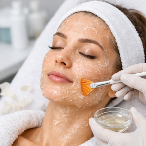 Peeling chemiczny (kwasowy)